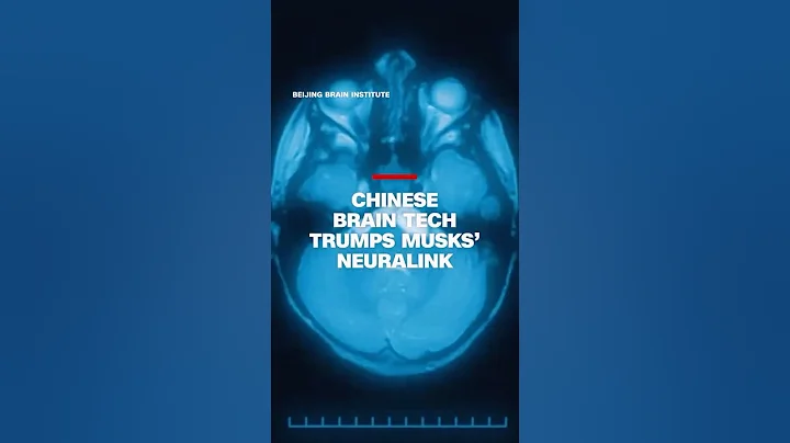 China brain tech rivals Musk’s Neuralink