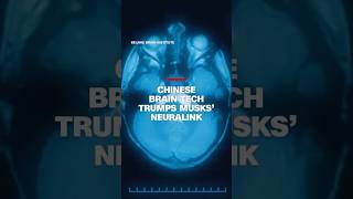 China Brain Tech Rivals Musks Neuralink