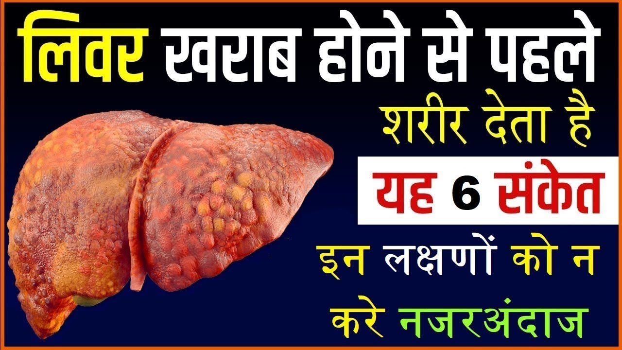 liver ki safai kaise kare liver me kharabi ke lakshan in hindi, liver