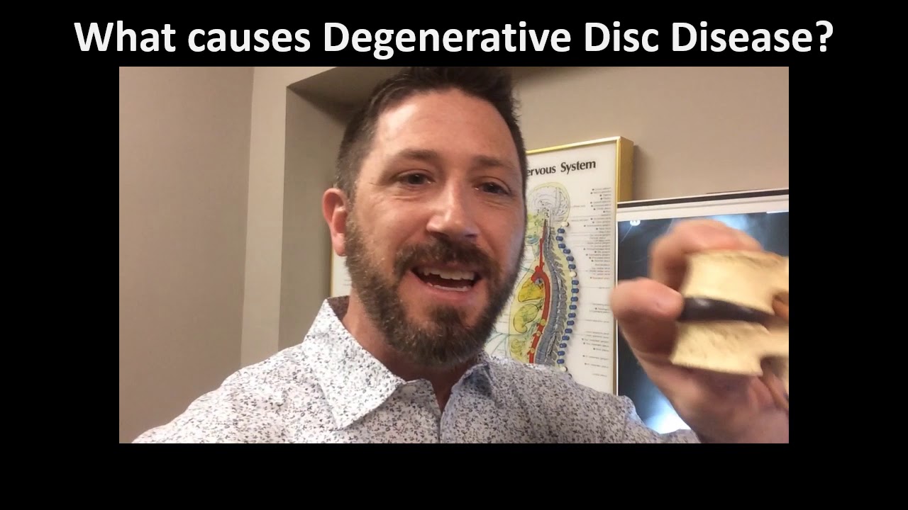 What Causes Degenerative Disc Disease? | Walton Clinic