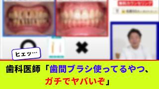 歯科医師「歯間ブラシ使ってるやつ、ガチでヤバいぞ」【2chまとめ】【2chスレ】【5chスレ】