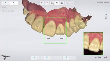 TRIOS Practice Lab   Veneer workflow