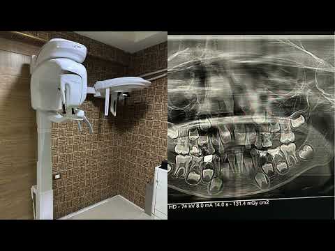 مركز القصاص للأشعة بدسوق