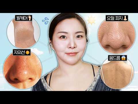 여름 고민? ㄹㅇ로 쉽게 해결 가능;;🫨 몸드름, 요철, 발 각질, 자외선차단 🔥4가지 박멸🔥