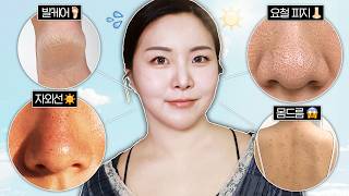 여름 고민? ㄹㅇ로 쉽게 해결 가능;;🫨 몸드름, 요철, 발 각질, 자외선차단 🔥4가지 박멸🔥