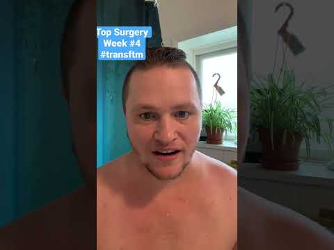 Top Surgery Results
