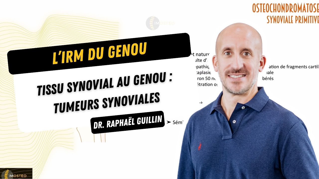 TUTORIEL IMOSTEO #12 : Tissu synovial au genou - Tumeurs synoviales