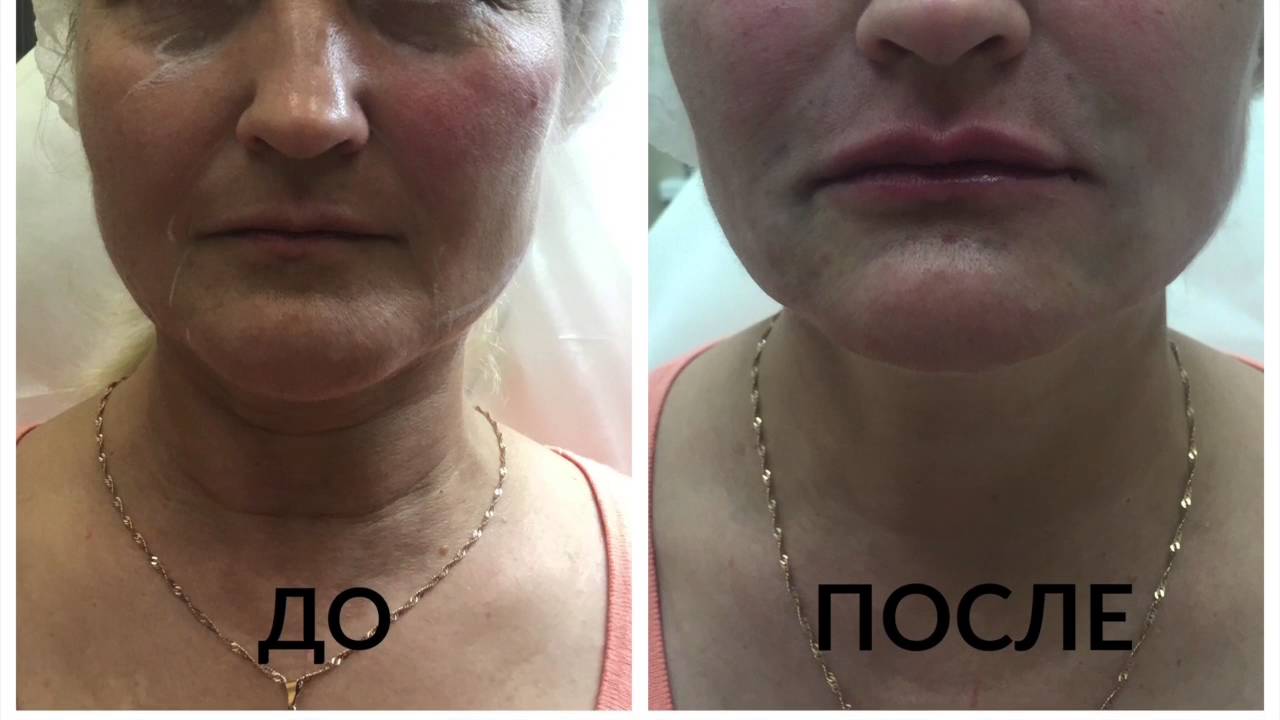 объемное моделирование  на 10 лет моложе