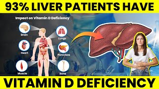 93% Chronic Liver Patients Have Vitamin D Deficiency | causes of vitamin d deficiency