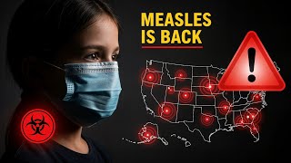 Measles Is Back: U.S. Cases Hit 30-Year High | Health Officials Sound the Alarm