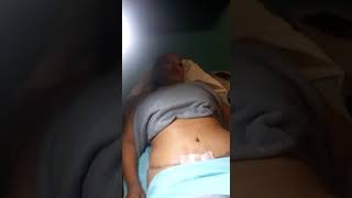 La de la después de debajo líquido liposucción piel