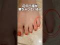 脚が太い原因マジでこれ🥺脚痩せなかなかしない人は、脚じゃなくて"足"に原因ある🦶まじで足が変わったらカリカリ脚なった😇 #脚痩せ #足痩せ #ダイエット #ダイエット記録