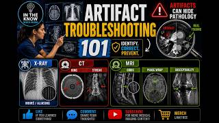 Artifact Troubleshooting 101: Identifying, Correcting & Preventing Imaging Errors 🩺⚡