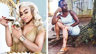 The American Celebrity Who Tried to Bleach Africans