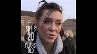Zara Hartshorn - At 16 She Looks Like Someone's Grandma: Rare Genetic Conditions