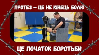 Фантомний біль, депресія, страх: правда про протезування
