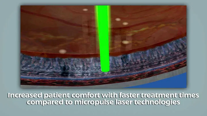 PASCAL - about Endpoint Management