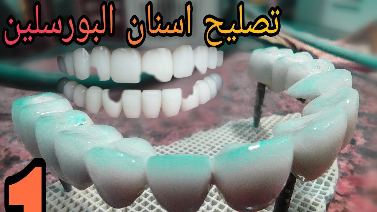 لو الاسنان البورسلين اتكسرت هتعمل ايه (الجزء الاول) Porcelain Teeth Repair