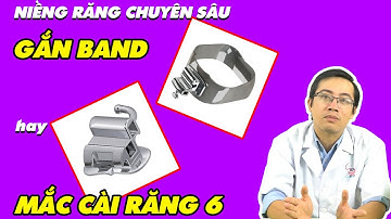 LỰA CHỌN BAND HAY MẮC CÀI RĂNG 6 TRONG CHỈNH NHA???