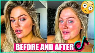Before And After 😮 Bold Glamour TikTok Filter