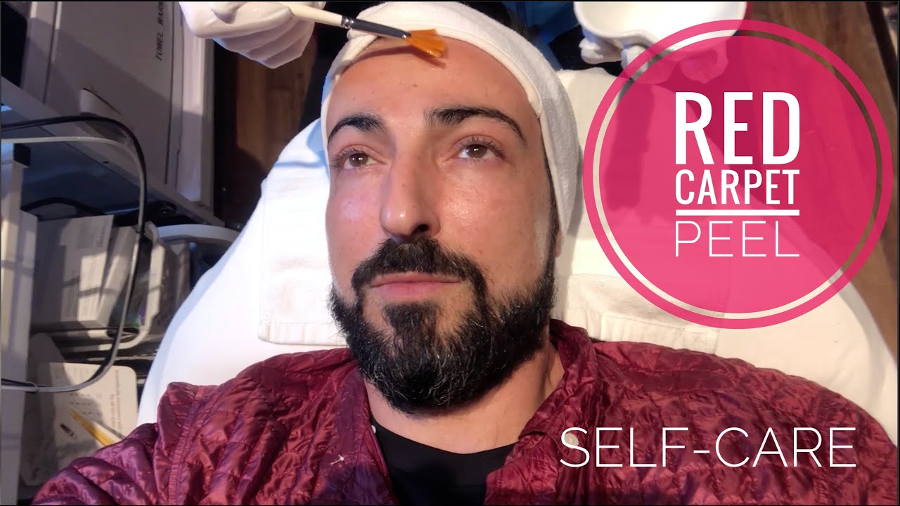 Red Carpet Ready Peel Review YouTube