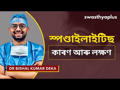 স্পণ্ডাইলাইটিছৰ কাৰণ আৰু লক্ষণ | Spondylitis: Signs & Treatment in Assamese | Dr Bishal Deka