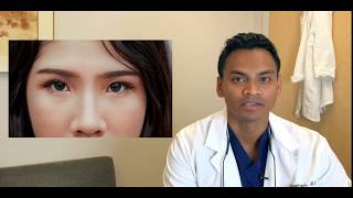 Volbella For Tear Trough