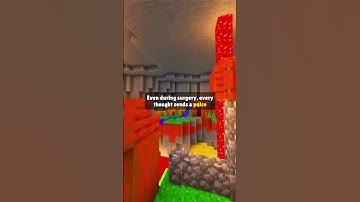 Your brain is more powerful than any supercomputer ever🧠#facts #science #mindblowing #shorts