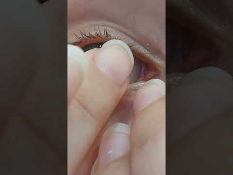 how to remove contact lenses/ как снимать контактные линзы