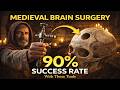 How Medieval Surgeons Performed Brain Surgery With 90% Success Rate