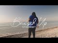 Shaqstar  bruised up official music