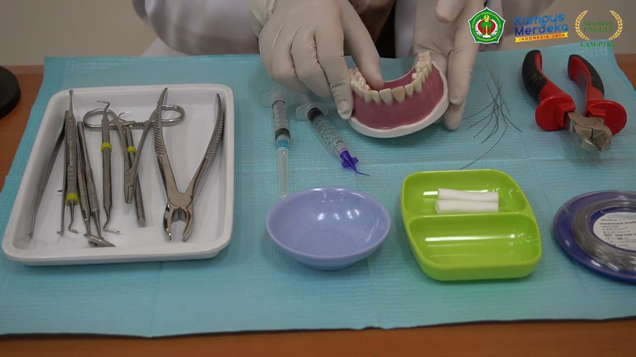 Replantasi gigi avulsi dengan Essig wire splint | Tichvy Tammama, drg., Sp.BM