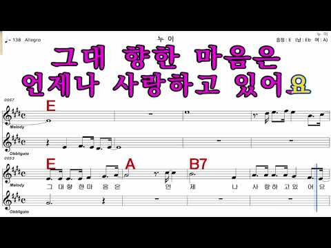누이  설운도   가수처럼 엠알로  악보  노래 하기  남 원키  E