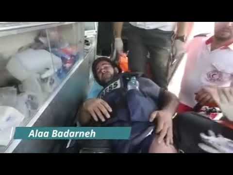 اصابة المصور ايمن نوباني في بيتا جنوب نابلس