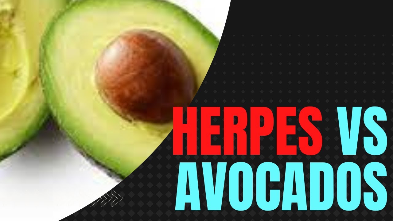 so-avocados-make-herpes-worse-coach-maria-teaches-facts-youtube