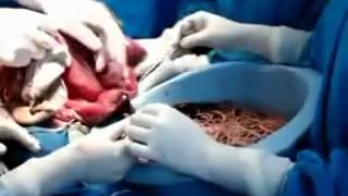 Eggs in the drug to lose weight