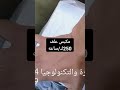 مكبس علف الدواجن 250ك ساعه