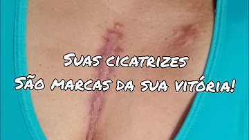 Como é a cicatriz do Marca-passo?