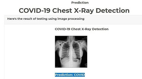 Diagnosis of COVID-19 from Chest X-Ray Images Using Wavelets-Based Depthwise Convolution Network