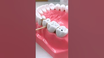 Floss your teeth | Your Dentist #shorts #shortvideo #short #viral