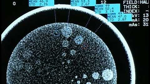 Catphan® 500 Instructional Video