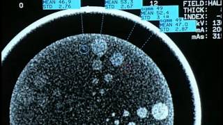 Catphan® 500 Instructional Video