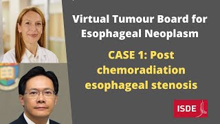 Post chemoradiation esophageal stenosis: Esophageal Neoplasm Case 1