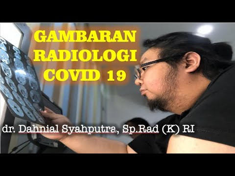Gambaran Radiologi Covid 19 Oleh dr. Dahnial Syahputra, Sp.Rad. (K) RI