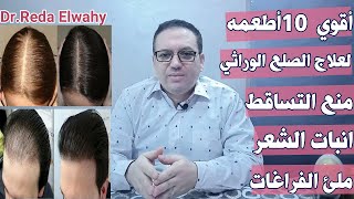 أقو 10 أطعمه لعلاج الصلع الوراثي ومنع التساقط واعادة انبات الشعر وزيادة طول وكثافه الشعر بامان تام