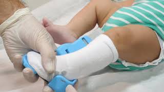 UNFO brace installation instructions & protocol, for professionals