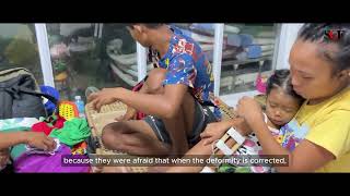 Meet our Cleft Lip & Palate Surgeons | EPISODE 4