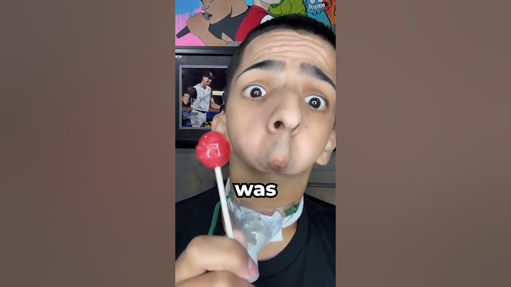 BORN Without a Chin and Became a RAPPER 🎤 (Isaiah Acosta)