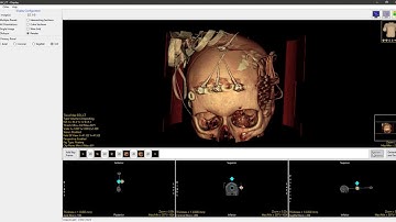 Analyze 14.0 - Display: Advanced Movie Making with the Perspective Tool