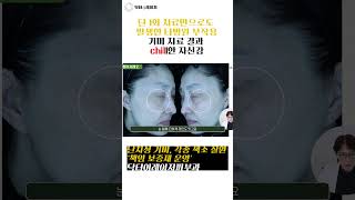 기미 타병원 부작용 치료 사례 #닥터이레이저 #shorts